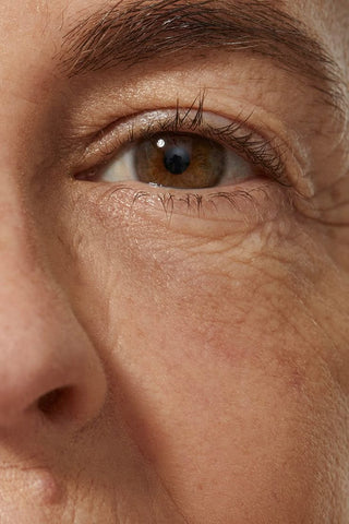 Signs of Ageing | Anti-aging Skincare Products | kasscare.com