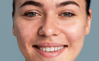 After using Acne Solution of Kass