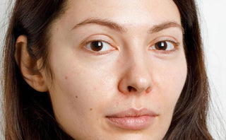 Before Using Kass Brightening Serum