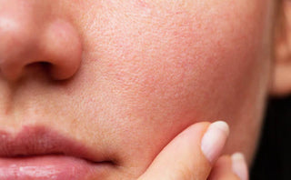 After Using Pore Minimizer Serum