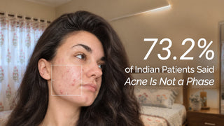 73.2% of Indian Patients Said Acne Is Not a Phase