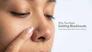 Can Kass De-Pigmentation Serum Be the Key to Banishing Dark Spots?