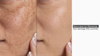 Skincare to Reverse Sun Damage This Summer