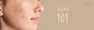 Why Do Adults Get Acne And How To Clear Adult Acne?
