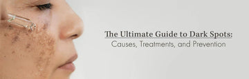 Guide to Dark Spots: Causes, Treatments, and Prevention