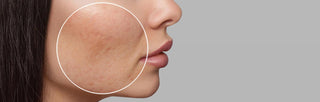 pore minimizer serum