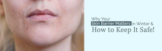 Skin Barrier Matters in Winter