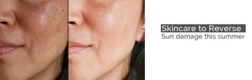 Skincare to Reverse Sun Damage This Summer