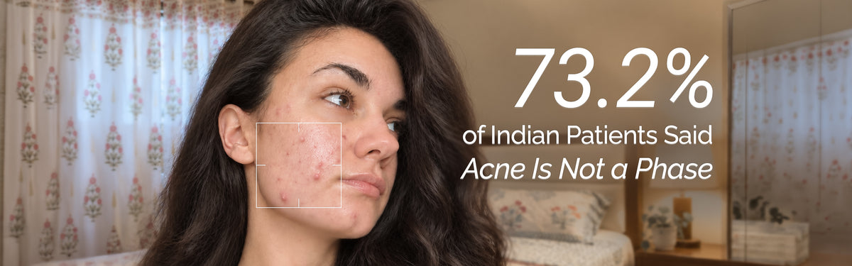 73.2% of Indian Patients Said Acne Is Not a Phase