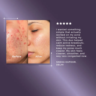 Acne Curb