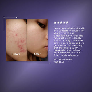 Break the Acne Cycle