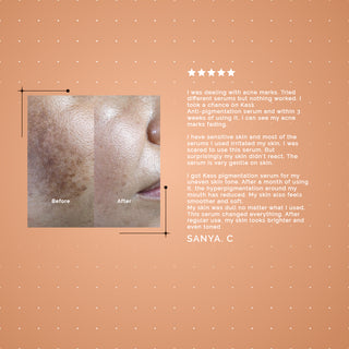 DE-PIGMENTATION SERUM