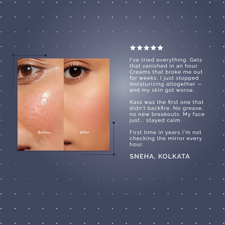 MATTIFYING GEL MOISTURIZER
