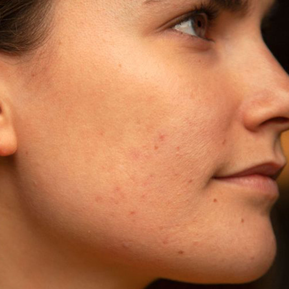 Before using Kass skin barrier fix cream