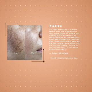 DEPIGMENTATION SERUM
