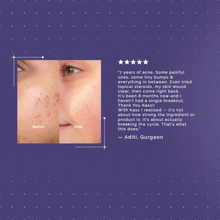 ACNE SOLUTIONS SERUM