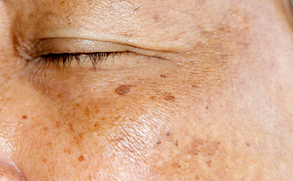 Before using Depigmentation Serum