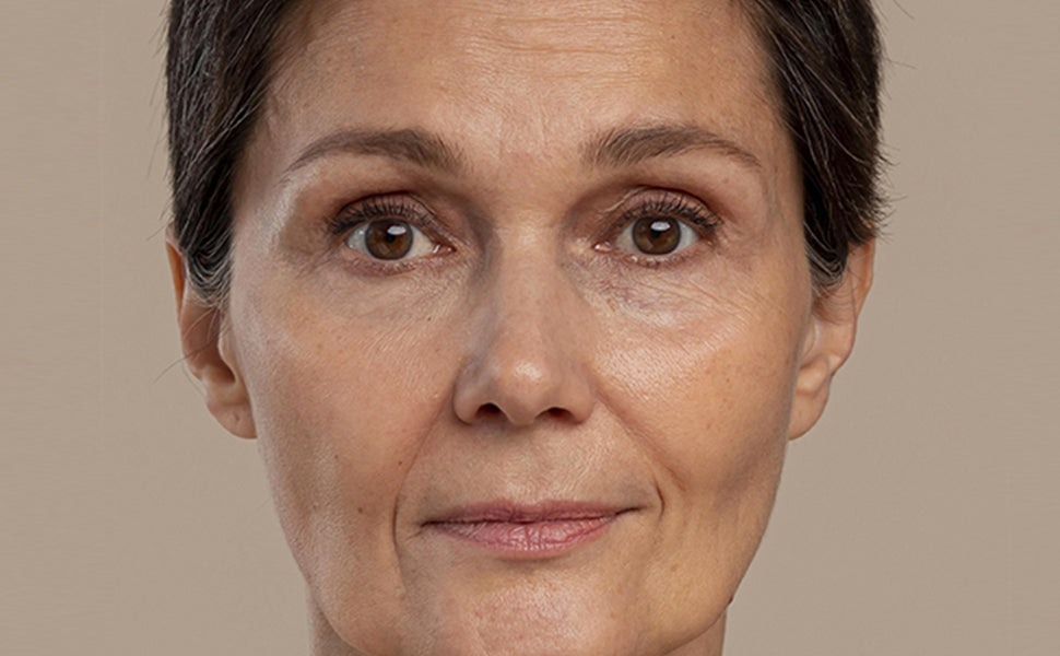 Lady Face Before using of Retinol Serum