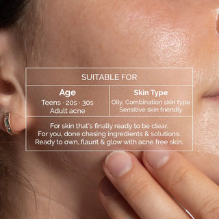 ACNE SOLUTIONS SERUM